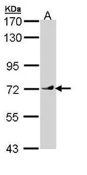 Anti-VANGL1 antibody [N1C1] used in Western Blot (WB). GTX110123