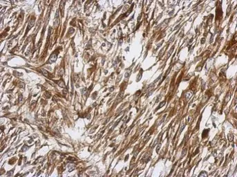 Anti-PKC theta antibody [N1N3-2] used in IHC (Paraffin sections) (IHC-P). GTX110127