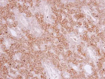 Anti-PIGR antibody [N2C1], Internal used in IHC (Paraffin sections) (IHC-P). GTX110197