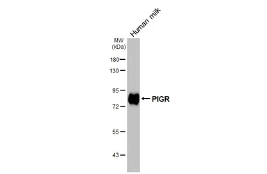 Anti-PIGR antibody [N2C1], Internal used in Western Blot (WB). GTX110197