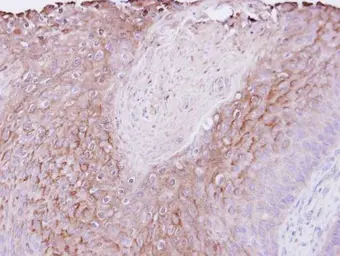 Anti-PIGR antibody [N2C1], Internal used in IHC (Paraffin sections) (IHC-P). GTX110197