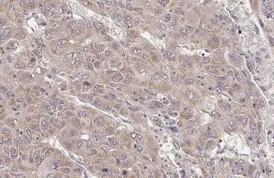 Anti-PAPSS2 antibody [C1C3] used in IHC (Paraffin sections) (IHC-P). GTX110232