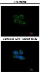 Anti-PAPSS2 antibody [C1C3] used in Immunocytochemistry/ Immunofluorescence (ICC/IF). GTX110232