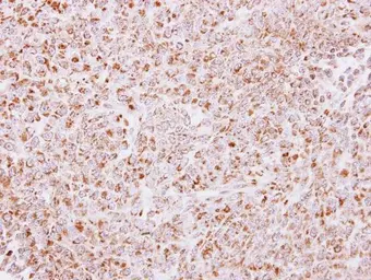 Anti-PAPSS2 antibody [C1C3] used in IHC (Paraffin sections) (IHC-P). GTX110232