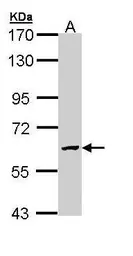 Anti-GALNS antibody used in Western Blot (WB). GTX110237