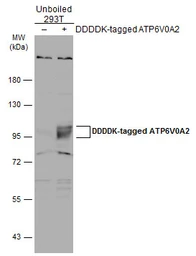 Anti-ATP6V0A2 antibody [N2C1], Internal used in Western Blot (WB). GTX110248