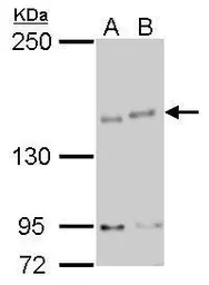 Anti-IKAP antibody [C1C2], Internal used in Western Blot (WB). GTX110274