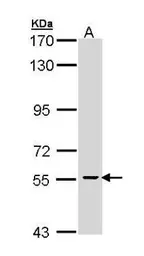 Anti-CDC73 antibody [N1C1] used in Western Blot (WB). GTX110280