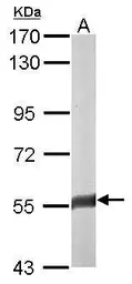 Anti-FAM126A antibody [N3C3] used in Western Blot (WB). GTX110304