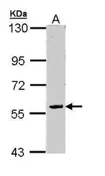 Anti-FAM126A antibody [N3C3] used in Western Blot (WB). GTX110304