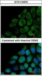 Anti-COG8 antibody [N3C3] used in Immunocytochemistry/ Immunofluorescence (ICC/IF). GTX110375