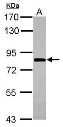 Anti-COG8 antibody [N3C3] used in Western Blot (WB). GTX110375