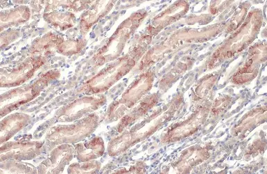 Anti-ENaC Alpha antibody [N3C2], Internal used in IHC (Paraffin sections) (IHC-P). GTX110436