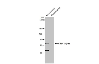 Anti-ENaC Alpha antibody [N3C2], Internal used in Western Blot (WB). GTX110436