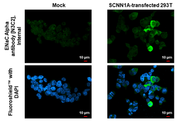 Anti-ENaC Alpha antibody [N3C2], Internal used in Immunocytochemistry/ Immunofluorescence (ICC/IF). GTX110436