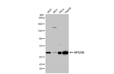 Anti-VPS33B antibody [N3C2], Internal used in Western Blot (WB). GTX110467