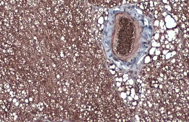 Anti-Fatty Acid Synthase antibody [N1N2], N-term used in IHC (Paraffin sections) (IHC-P). GTX110470