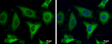 Anti-Fatty Acid Synthase antibody [N1N2], N-term used in Immunocytochemistry/ Immunofluorescence (ICC/IF). GTX110470