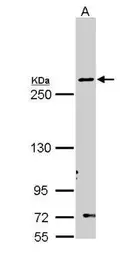 Anti-Fatty Acid Synthase antibody [N1N2], N-term used in Western Blot (WB). GTX110470