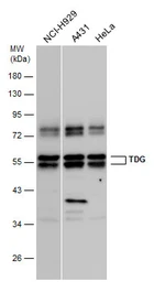 Anti-TDG antibody used in Western Blot (WB). GTX110473