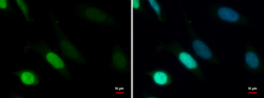 Anti-TDG antibody used in Immunocytochemistry/ Immunofluorescence (ICC/IF). GTX110473