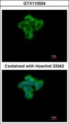 Anti-SENP2 antibody [N1], N-term used in Immunocytochemistry/ Immunofluorescence (ICC/IF). GTX110504