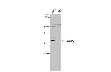 Anti-SENP2 antibody [N1], N-term used in Western Blot (WB). GTX110504