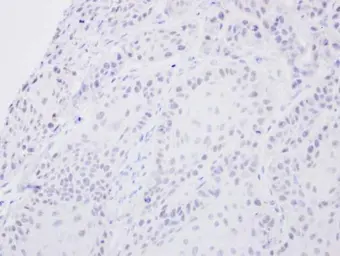 Anti-SENP2 antibody [N1], N-term used in IHC (Paraffin sections) (IHC-P). GTX110504