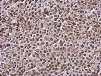 Anti-TIGAR antibody [C2C3], C-term used in IHC (Paraffin sections) (IHC-P). GTX110514