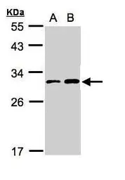 Anti-TIGAR antibody [C2C3], C-term used in Western Blot (WB). GTX110514