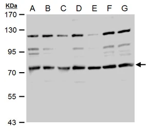 Anti-TACC2 antibody used in Western Blot (WB). GTX110516