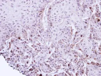 Anti-TACC2 antibody used in IHC (Paraffin sections) (IHC-P). GTX110516