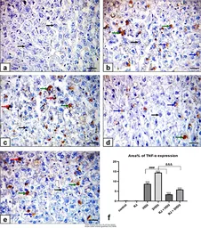 Anti-TNF alpha antibody used in IHC (Paraffin sections) (IHC-P). GTX110520