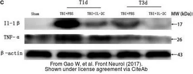 Anti-TNF alpha antibody used in Western Blot (WB). GTX110520