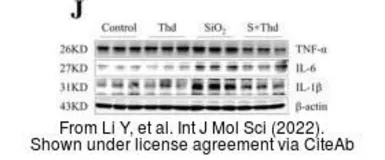 Anti-TNF alpha antibody used in Western Blot (WB). GTX110520