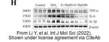 Anti-TNF alpha antibody used in Western Blot (WB). GTX110520