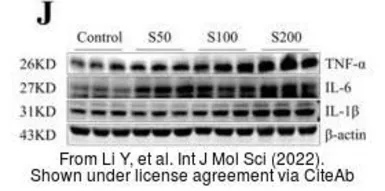 Anti-TNF alpha antibody used in Western Blot (WB). GTX110520