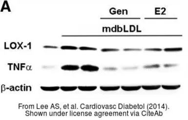 Anti-TNF alpha antibody used in Western Blot (WB). GTX110520