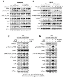 Anti-TNF alpha antibody used in Western Blot (WB). GTX110520