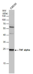 Anti-TNF alpha antibody used in Western Blot (WB). GTX110520