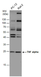 Anti-TNF alpha antibody used in Western Blot (WB). GTX110520