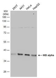 Anti-IKB alpha antibody used in Western Blot (WB). GTX110521