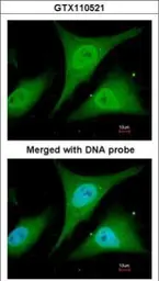 Anti-IKB alpha antibody used in Immunocytochemistry/ Immunofluorescence (ICC/IF). GTX110521