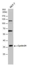 Anti-Cyclin D1 antibody [N1C3-2] used in Western Blot (WB). GTX110541