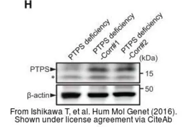 Anti-PTS antibody [N1C3] used in Western Blot (WB). GTX110549