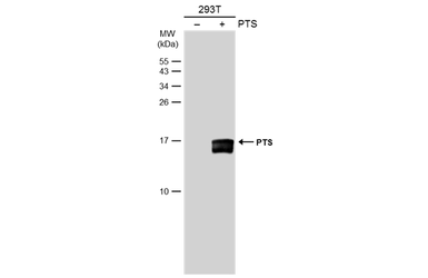 Anti-PTS antibody [N1C3] used in Western Blot (WB). GTX110549