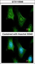 Anti-PTS antibody [N1C3] used in Immunocytochemistry/ Immunofluorescence (ICC/IF). GTX110549