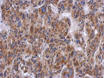 Anti-PTS antibody [N1C3] used in IHC (Paraffin sections) (IHC-P). GTX110549