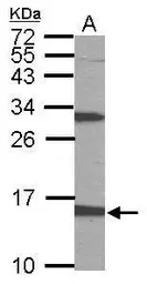 Anti-PTS antibody [N1C3] used in Western Blot (WB). GTX110549