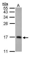 Anti-PTS antibody [N1C3] used in Western Blot (WB). GTX110549